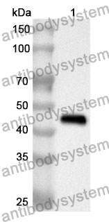 Anti-SMA /ACTA2 Polyclonal Antibody