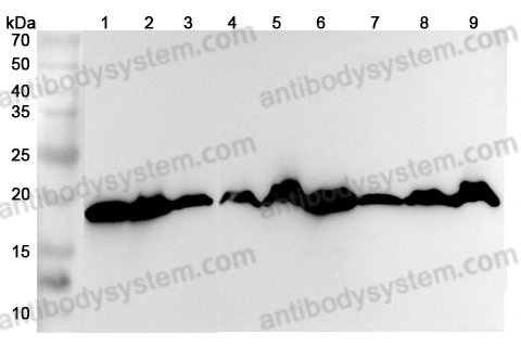 Anti-Human RPL23A Polyclonal Antibody