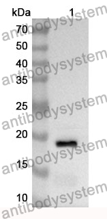 Anti-VSNL1 Polyclonal Antibody