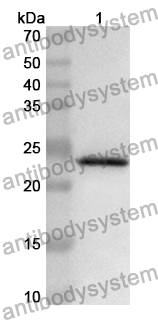 Anti-RAB1A Polyclonal Antibody