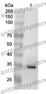 Anti-Human RBX1 Polyclonal Antibody