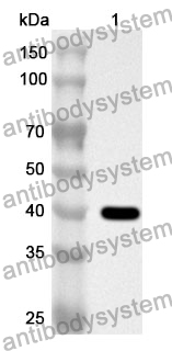 Anti-GNB2 Polyclonal Antibody