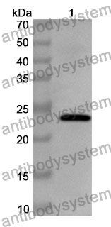 Anti-RAC1 Polyclonal Antibody