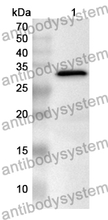 Anti-AP2B1 Polyclonal Antibody