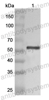 Anti-Human PPP2R2A Polyclonal Antibody