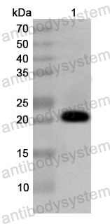 Anti-Human SNRPN Polyclonal Antibody