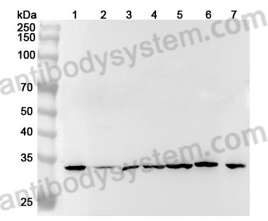 Anti-Human DYNLT1 Polyclonal Antibody