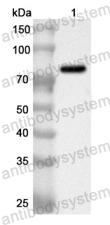 Anti-Human RACK1 Polyclonal Antibody