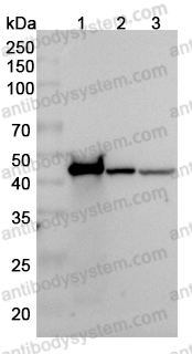 Anti-ACTG1 Polyclonal Antibody