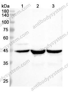 Anti-ACTG2 Polyclonal Antibody