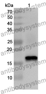 Anti-UBE2I/UBC9 Polyclonal Antibody