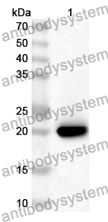 Anti-Human TNNC1 Polyclonal Antibody