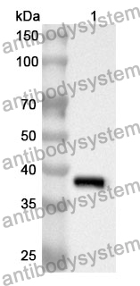 Anti-Human PPP2CA Polyclonal Antibody