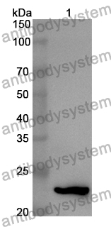 Anti-Human CSNK2B Polyclonal Antibody