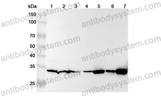 Anti-Human TPM4 Polyclonal Antibody