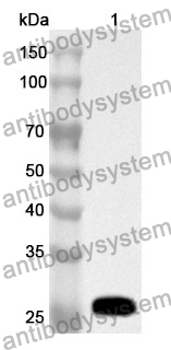 Anti-ACTC1 Polyclonal Antibody