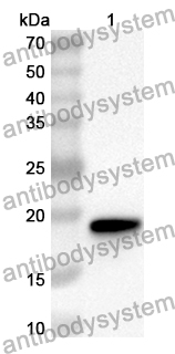 Anti-UBE2L3 Polyclonal Antibody