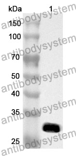 Anti-EEF1A1 Polyclonal Antibody