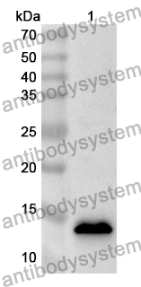 Anti-FKBP1B Polyclonal Antibody