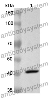 Anti-Human CSNK2A1/CK2A1 Polyclonal Antibody