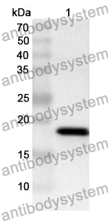 Anti-HBA1 Polyclonal Antibody