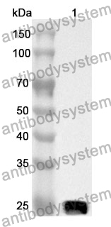 Anti-CXADR Polyclonal Antibody