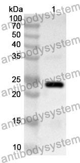 Anti-Human CD156a/ADAM8 Polyclonal Antibody