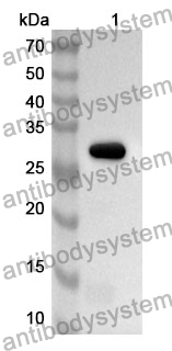 Anti-Human PSPH Polyclonal Antibody