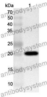 Anti-PITX1 Polyclonal Antibody