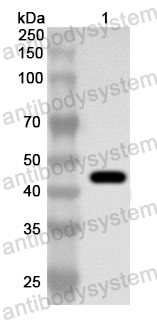 Anti-Human ASIC1 Polyclonal Antibody