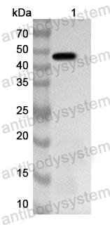 Anti-PIP4K2B/PIP4KII-beta Polyclonal Antibody