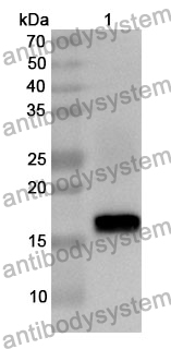 Anti-CTAG1A/NY-ESO-1/LAGE-2 Polyclonal Antibody