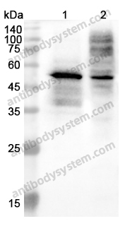 Anti-OLR1 Polyclonal Antibody