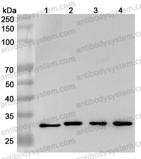 Anti-Human GSTO1 Polyclonal Antibody