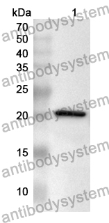 Anti-NKX6-1 Polyclonal Antibody