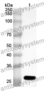 Anti-KCNJ10 Polyclonal Antibody