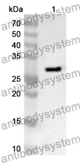 Anti-CD156b/ADAM17 Polyclonal Antibody