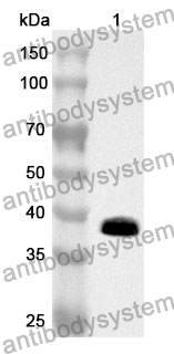 Anti-ARG2 Polyclonal Antibody