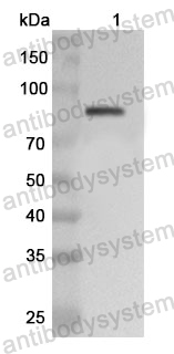 Anti-Human ADARB1 Polyclonal Antibody