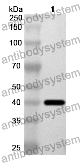 Anti-Human GPLD1 Polyclonal Antibody