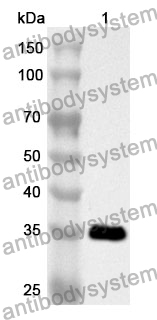 Anti-CXCL6/GCP-2 Polyclonal Antibody