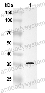 Anti-HSD11B2 Polyclonal Antibody