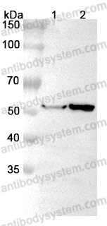 Anti-ABAT Polyclonal Antibody