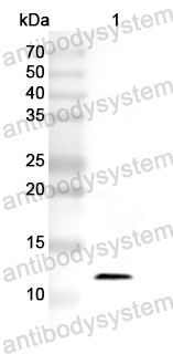 Anti-S100A12 Polyclonal Antibody