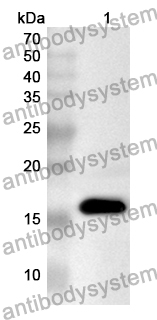 Anti-Human BASP1 Polyclonal Antibody