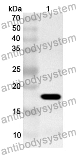 Anti-RBP5 Polyclonal Antibody