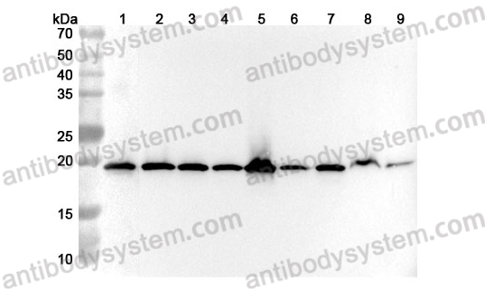 Anti-Human RPL24 Polyclonal Antibody