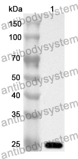 Anti-SMAD3 Polyclonal Antibody