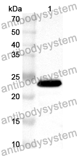 Anti-HPCA Polyclonal Antibody