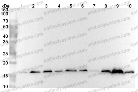 Anti-Human ARF1 Polyclonal Antibody